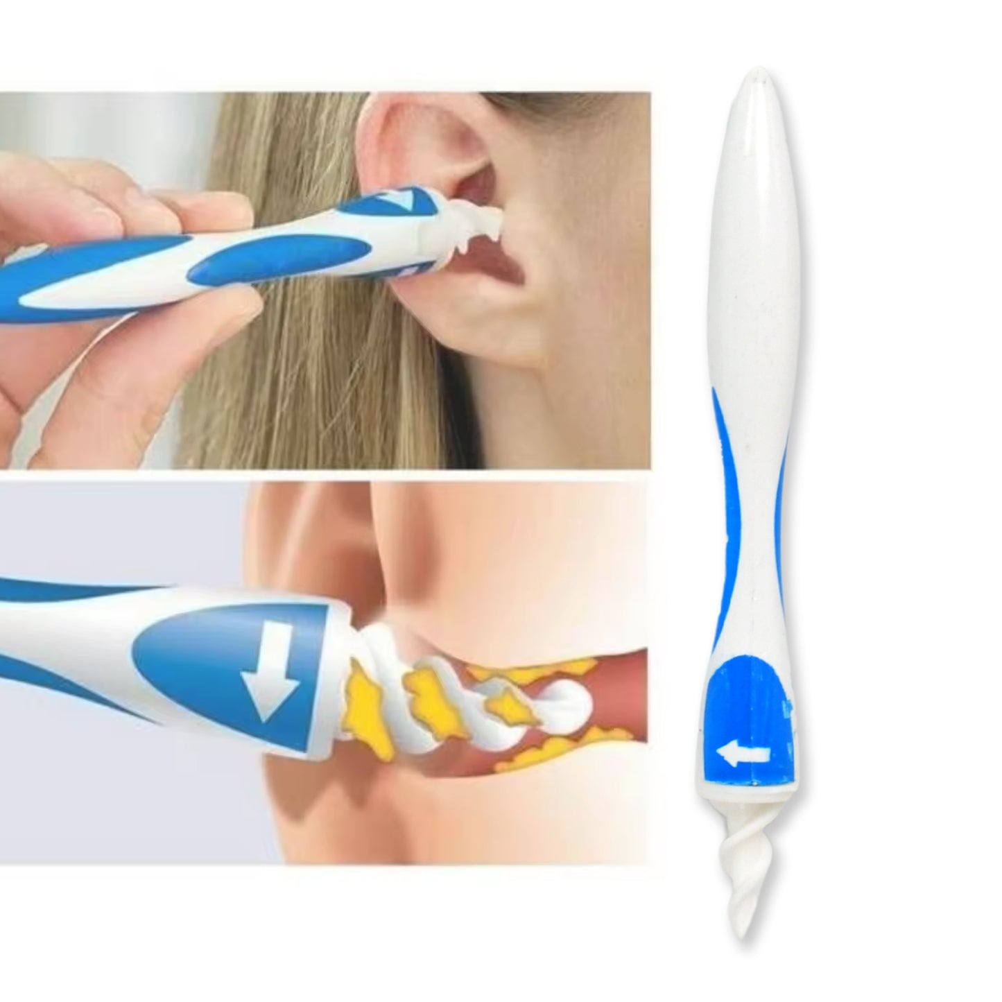 17698 Ear Wax Removal Ear Cleaner Earwax Remover Spiral Soft Silicone Safe Upgraded Smart Earwax Removal Tool Swab Kit With 16 Replacement Tips For Adults Kids