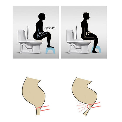 6005a Plastic Non-slip Folding Toilet Squat Stool - White Color